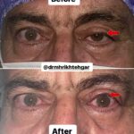 drrikhtegar_1696317864_highlight17956352377678991