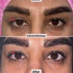 drrikhtegar_1696397509_highlight17956352377678991