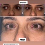 drrikhtegar_1696909827_highlight17972119831707223