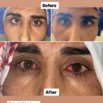 drrikhtegar_1696910220_highlight17972119831707223