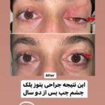 drrikhtegar_1697276364_highlight17956352377678991