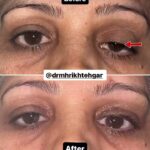 drrikhtegar_1698052627_highlight17956352377678991