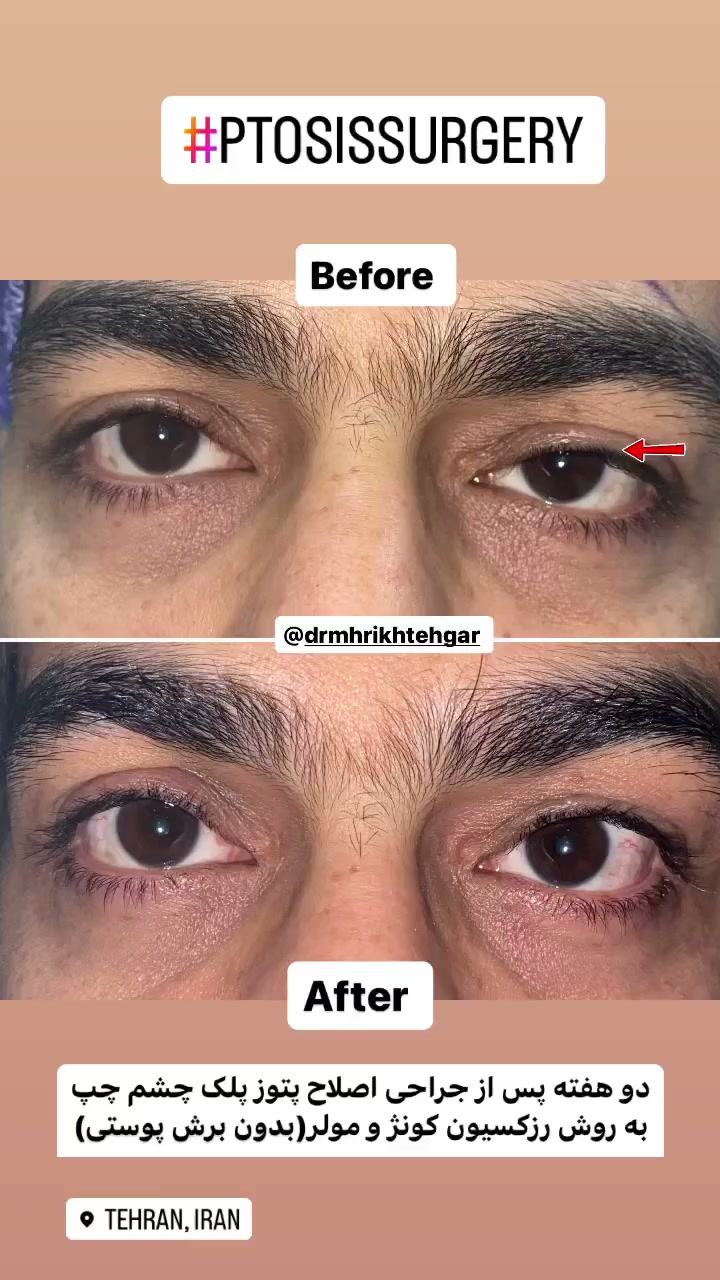 drrikhtegar_1698492203_highlight17956352377678991