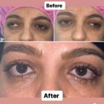 drrikhtegar_1698492327_highlight17972119831707223