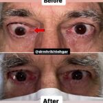 drrikhtegar_1700299227_highlight17972119831707223