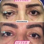 drrikhtegar_1700714176_highlight17956352377678991