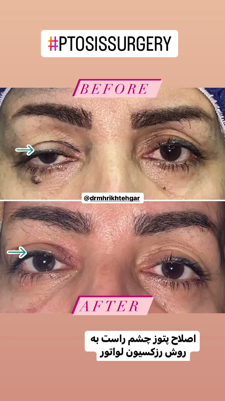 drrikhtegar_1700714176_highlight17956352377678991