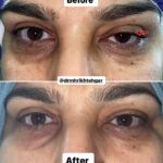 drrikhtegar_1700715675_highlight17956352377678991