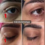 drrikhtegar_1701408543_highlight17847726442926162