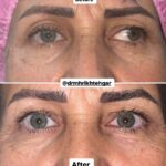 drrikhtegar_1701787254_highlight17972119831707223