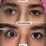 drrikhtegar_1701787338_highlight17972119831707223