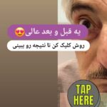 drrikhtegar_1709901362_highlight17847578672484440