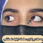 drrikhtegar_1712775555_highlight17972119831707223