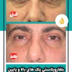 drrikhtegar_1741849730_highlight17927504468954631