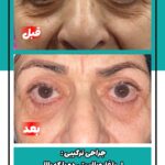 drrikhtegar_1744880781_highlight17927504468954631