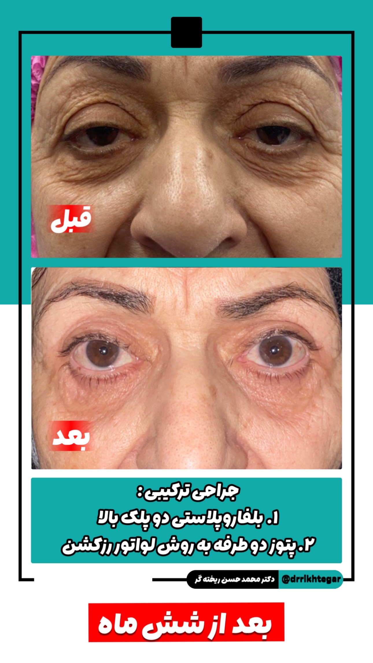 drrikhtegar_1744880781_highlight17927504468954631