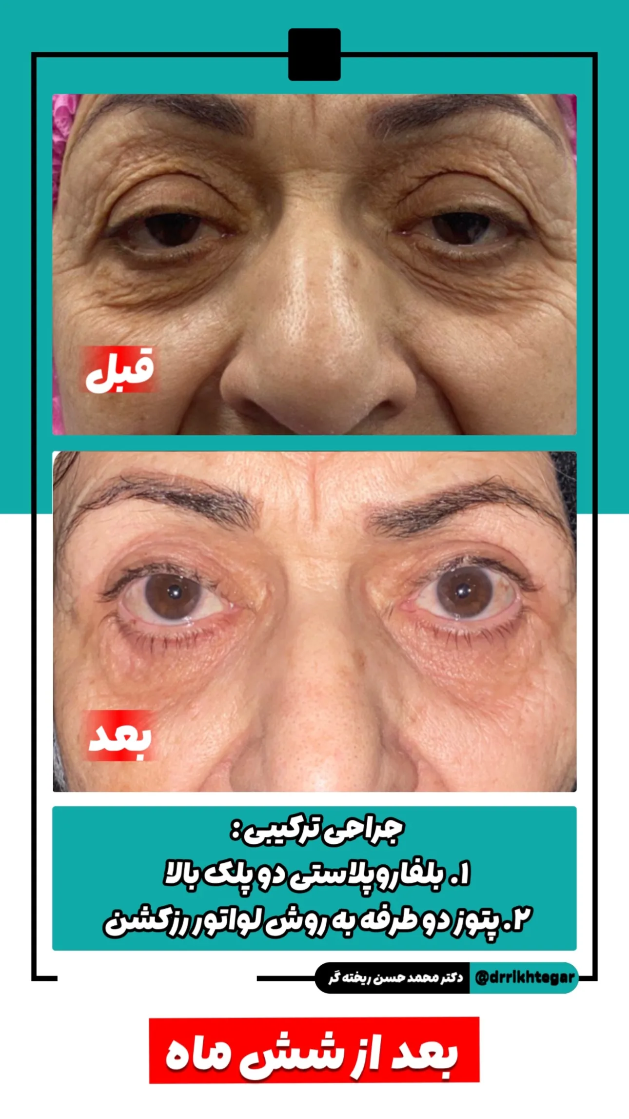 drrikhtegar_1744880781_highlight17927504468954631