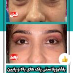 drrikhtegar_1745079421_highlight17927504468954631