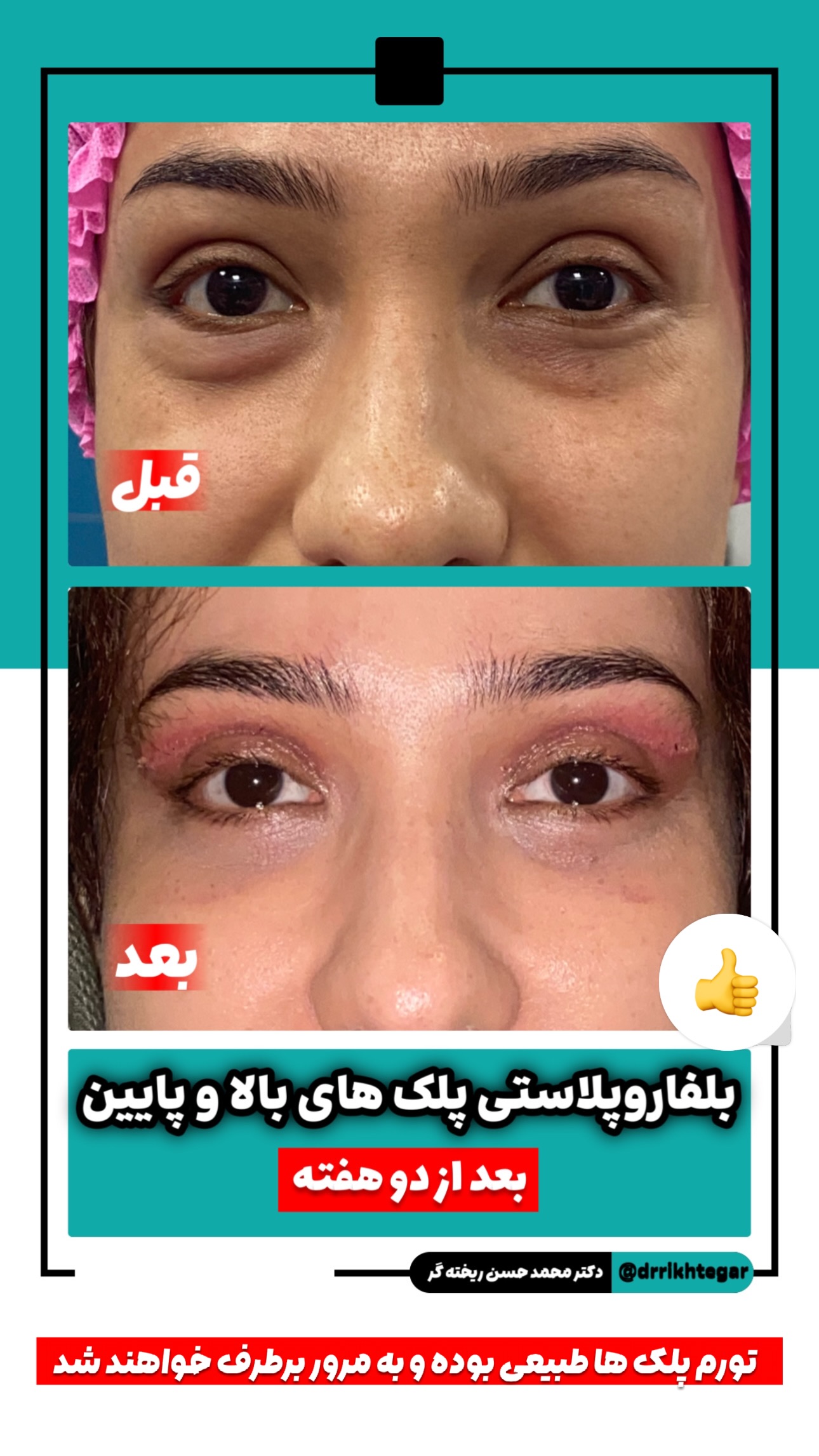 drrikhtegar_1745079421_highlight17927504468954631