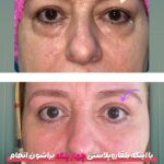 drrikhtegar_1745310742_highlight17927504468954631