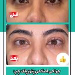 drrikhtegar_1749488096_highlight17956352377678991