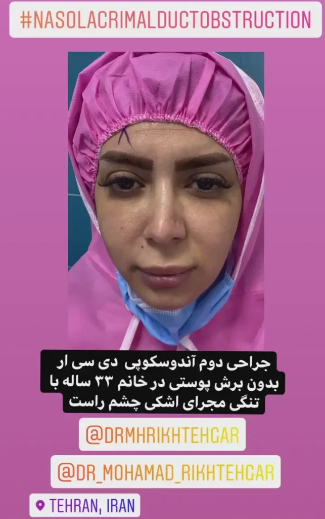 ریزش اشک مداوم و انسداد مجرای اشکی | راهنمای جامع 2025