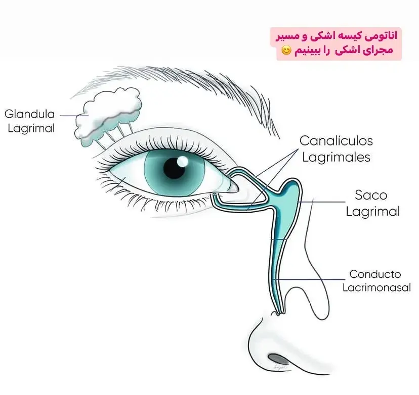ریزش اشک مداوم و انسداد مجرای اشکی | راهنمای جامع 2025