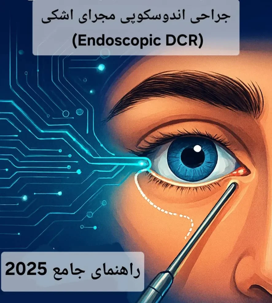 جراحی اندوسکوپی مجرای اشکی (Endoscopic DCR) | راهنمای جامع 2025