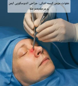 عفونت مزمن کیسه اشکی: جراحی اندوسکوپی ایمن و مرحله‌به‌مرحله