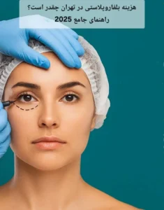 هزینه بلفاروپلاستی در تهران چقدر است؟ | راهنمای جامع 2025