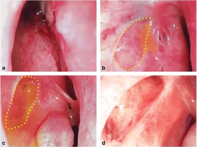تصویربرداری قبل از جراحی مجرای اشکی؛ چرا حیاتی است؟