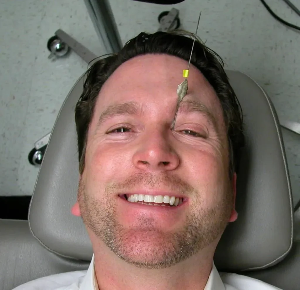 کیفیت زندگی بیماران قبل و بعد از جراحی اندوسکوپی مجرای اشکی