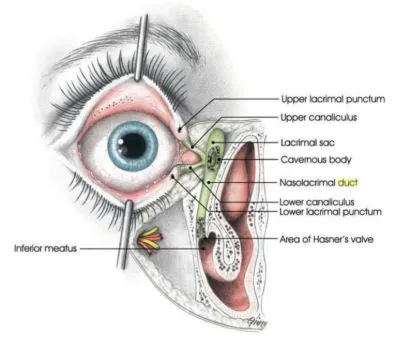 پرسش‌های متداول بیماران درباره جراحی اندوسکوپی مجرای اشکی