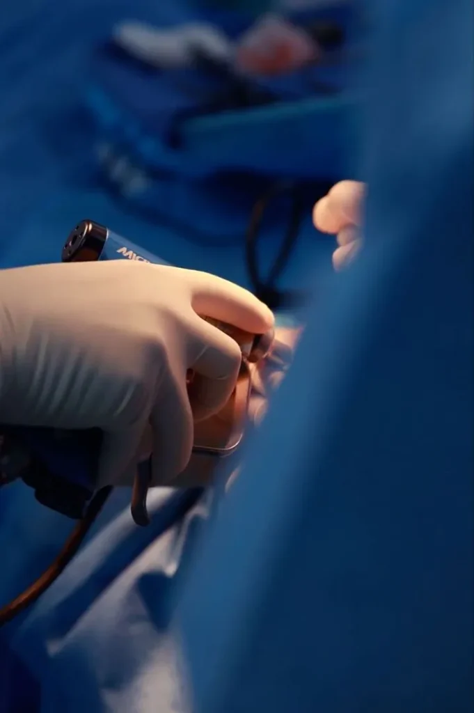 جراحی اندوسکوپی مجرای اشکی با بیحسی موضعی