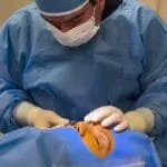 عوارض بلفاروپلاستی؛ حقایق و باورهای غلط