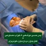 آیا بلفاروپلاستی درد دارد؟ بررسی علمی + تجربه بیماران