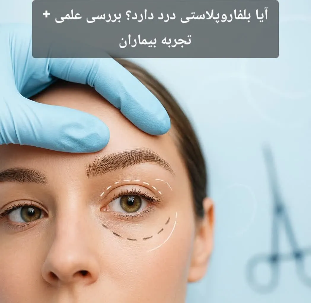 آیا بلفاروپلاستی درد دارد؟ بررسی علمی + تجربه بیماران