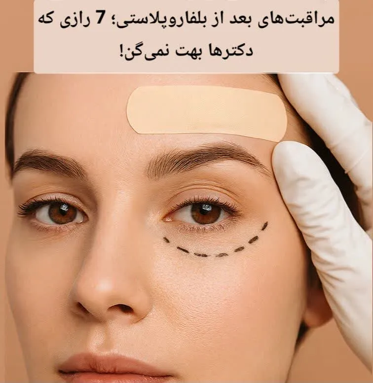 مراقبت‌های بعد از بلفاروپلاستی؛ 7 رازی که دکترها بهت نمی‌گن!