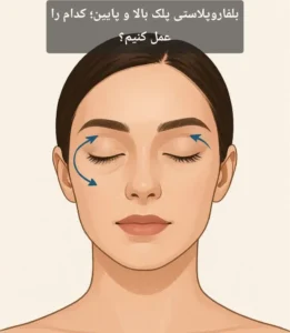 بلفاروپلاستی پلک بالا و پایین؛ کدام را عمل کنیم؟