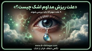 اشک ریزش مدام چشم
