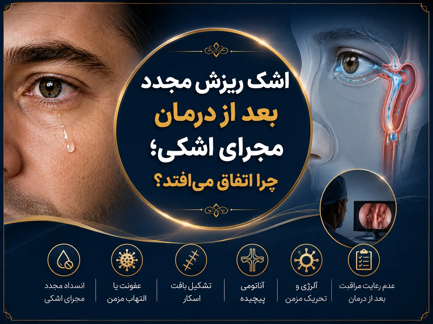 اشک ریزش مجدد بعد از درمان مجرای اشکی؛ چرا اتفاق می‌افتد؟