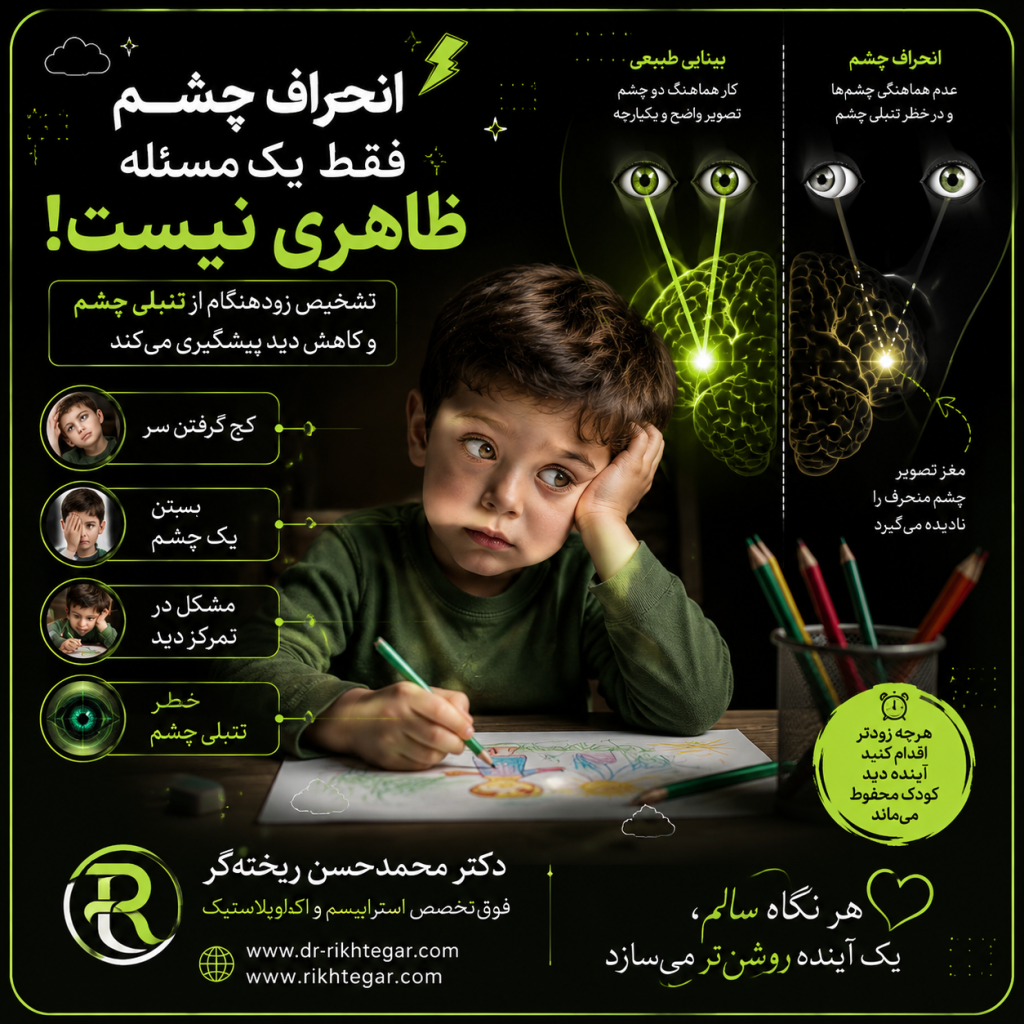 انحراف چشم در کودکان