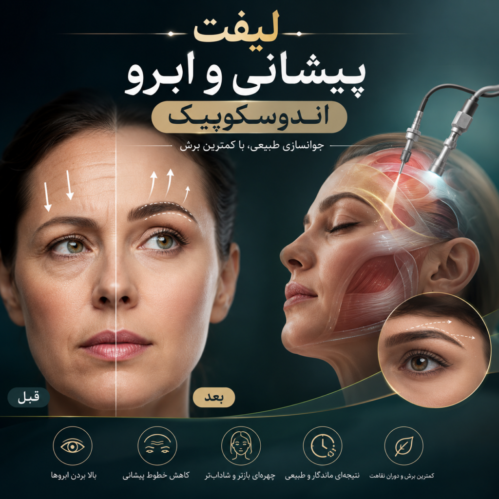لیفت پیشانی و ابرو اندوسکوپیک دقیقاً به چه معناست؟