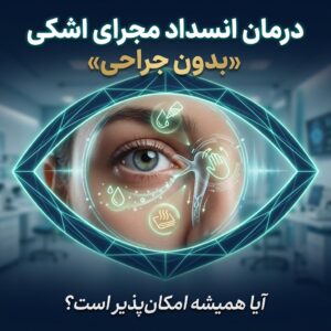 درمان انسداد مجرای اشکی بدون جراحی؛ آیا همیشه امکان‌پذیر است؟