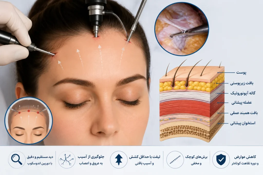 عوارض لیفت پیشانی و ابرو اندوسکوپیک چیست؟