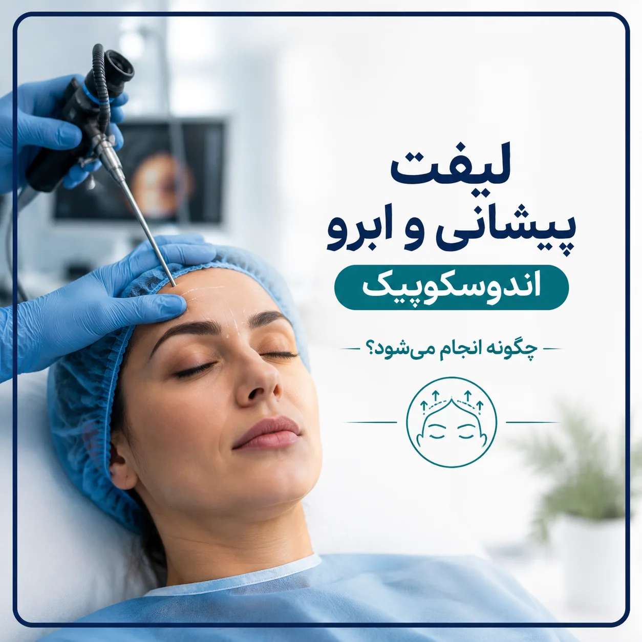 مراحل لیفت پیشانی و ابرو اندوسکوپیک