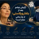 آرایش چشم بعد از بلفاروپلاستی؛ از چه زمانی مجاز است؟