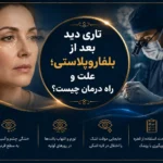 تاری دید بعد از بلفاروپلاستی؛ علت و راه درمان چیست؟
