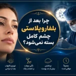 چرا بعد از بلفاروپلاستی چشم کامل بسته نمی‌شود؟