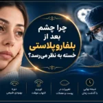 چشم خسته بعد از بلفاروپلاستی